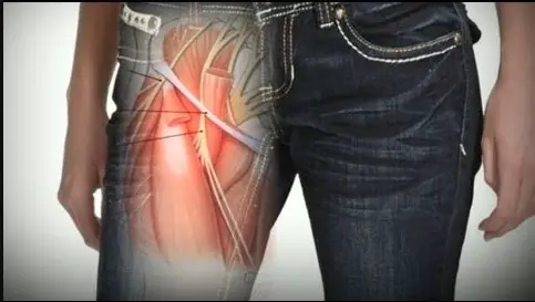 Can Skinny Jeans Cause Erectile Dysfunction